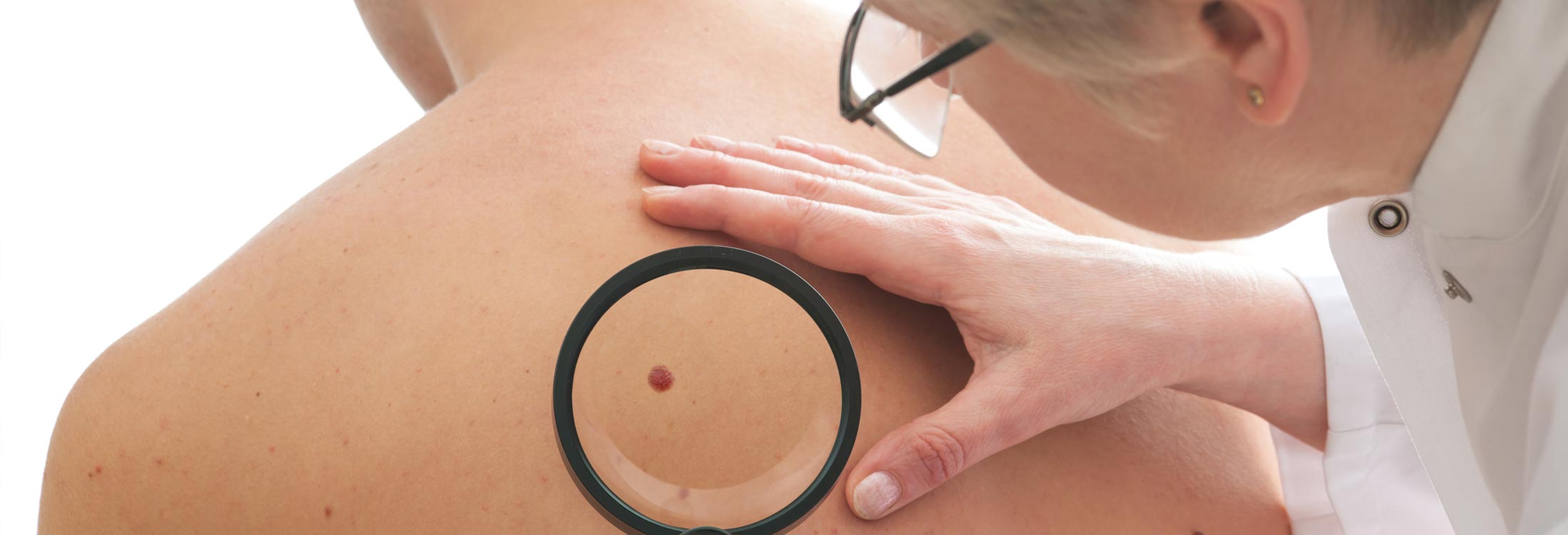 Skin cancer | American Academy of Dermatology