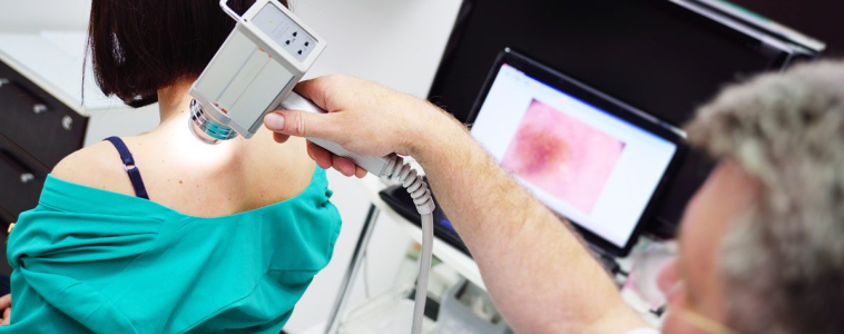 Quick lesion Analysis and Total Body Photography Services